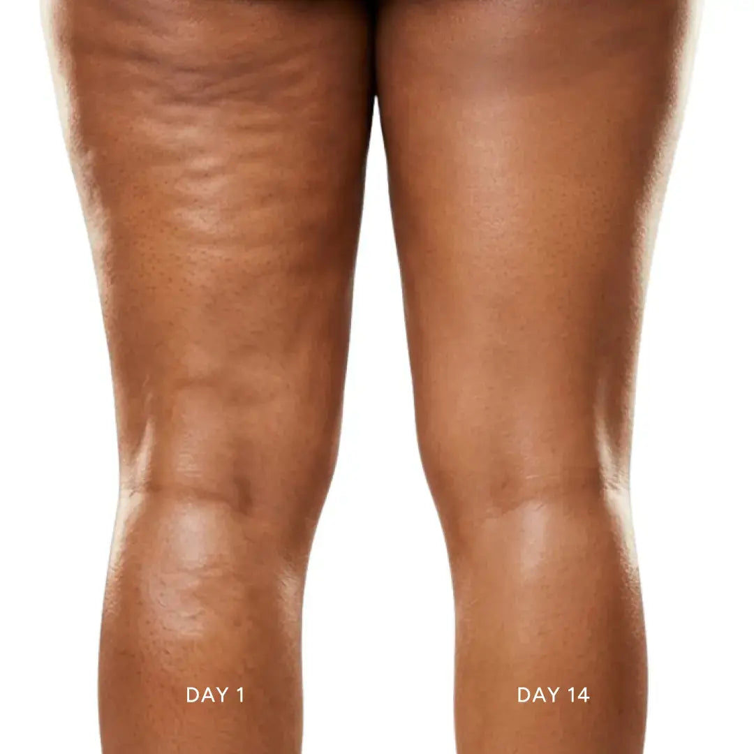 dermaQ 90-Day Kit